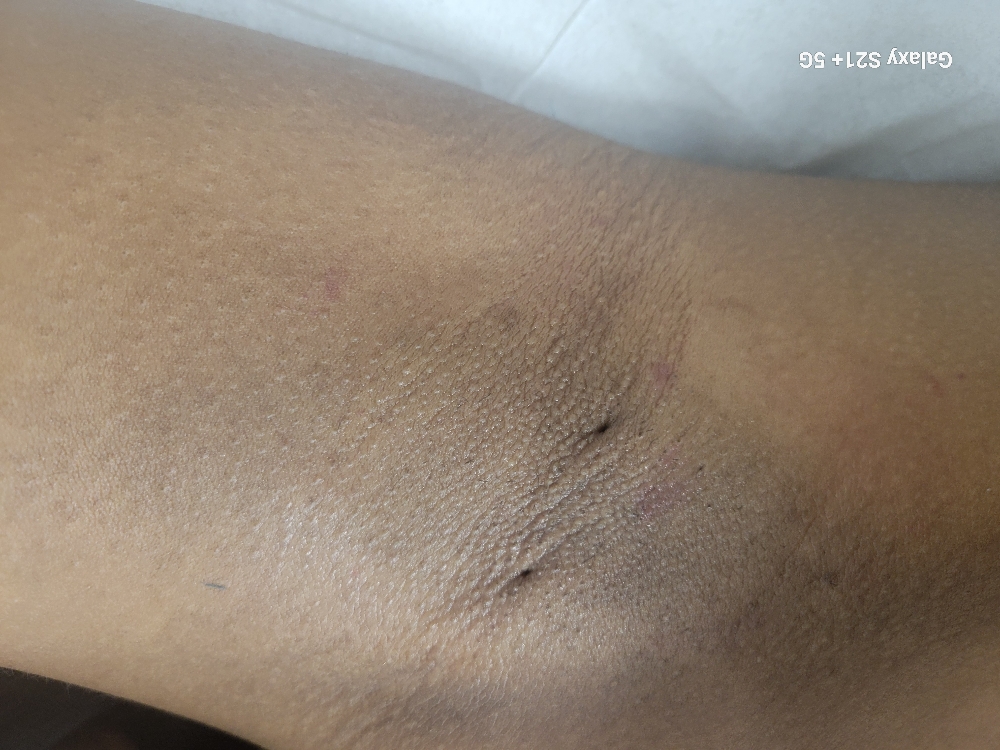 Underarm Wax