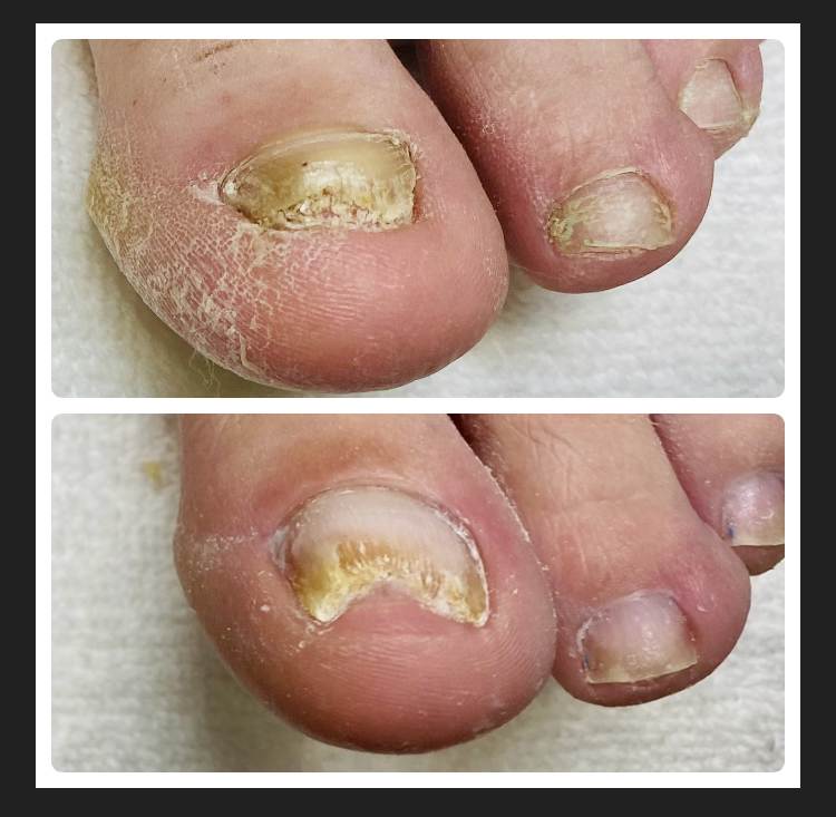 Medical Pedicure at Mountain Craft Salon in Kettle Falls, WA