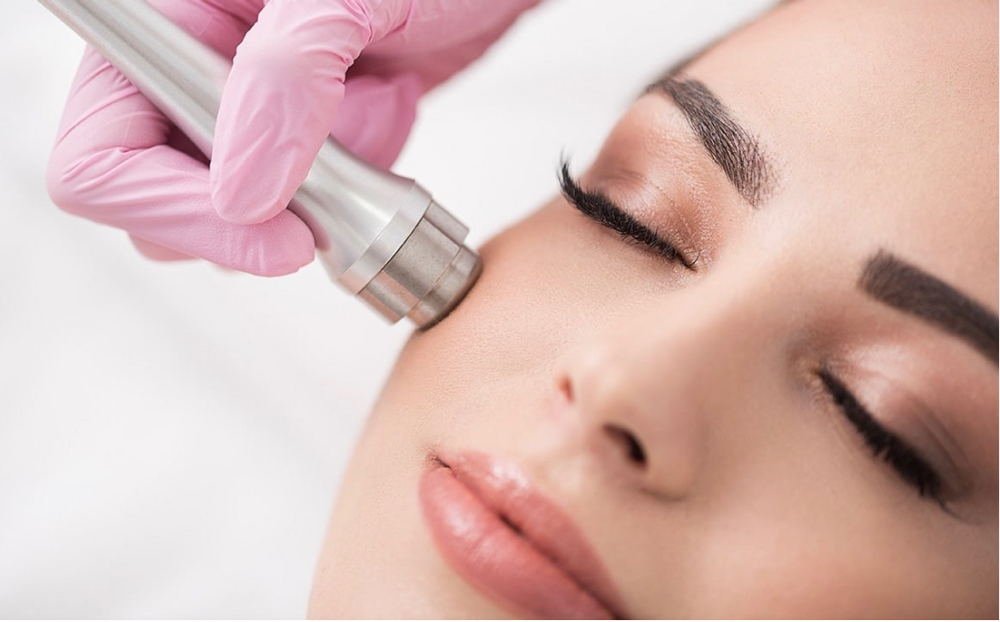 Microdermabrasion