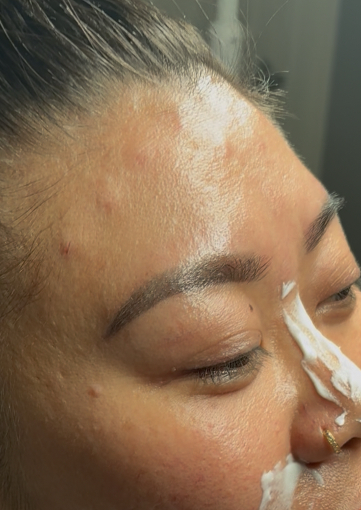 Tox Refresh - 30 Units at Balance.Bar.Aesthetics in Berkeley, CA