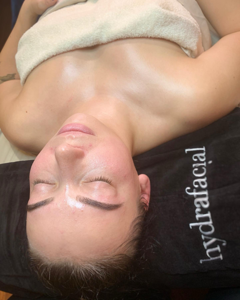 Express Hydrafacial