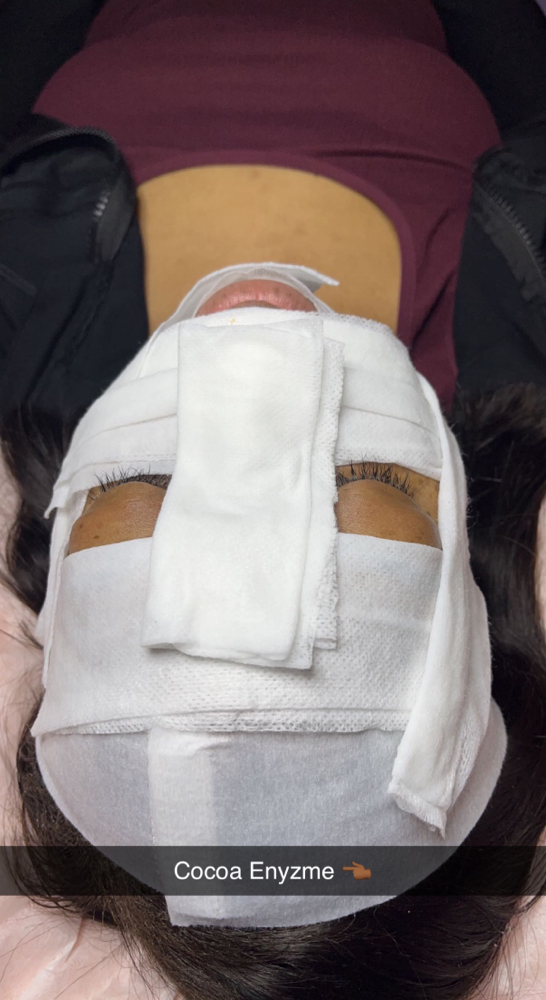 Graduation (Acne Scars/Treatment)