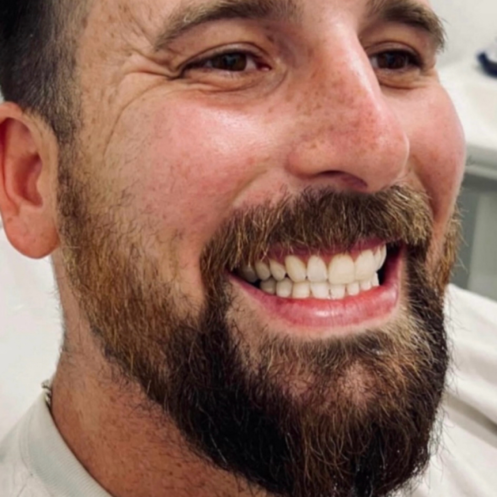 Deluxe Whitening at Advanced Teeth Whitening Beauty Studio in Rockwall, TX
