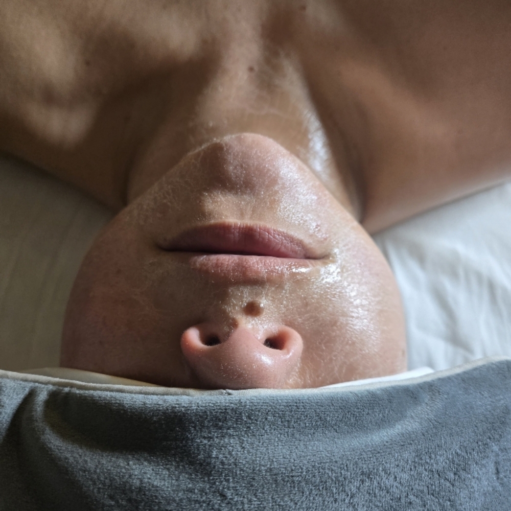 The Radiance Facial at Midtown Esthetics in Raleigh, NC