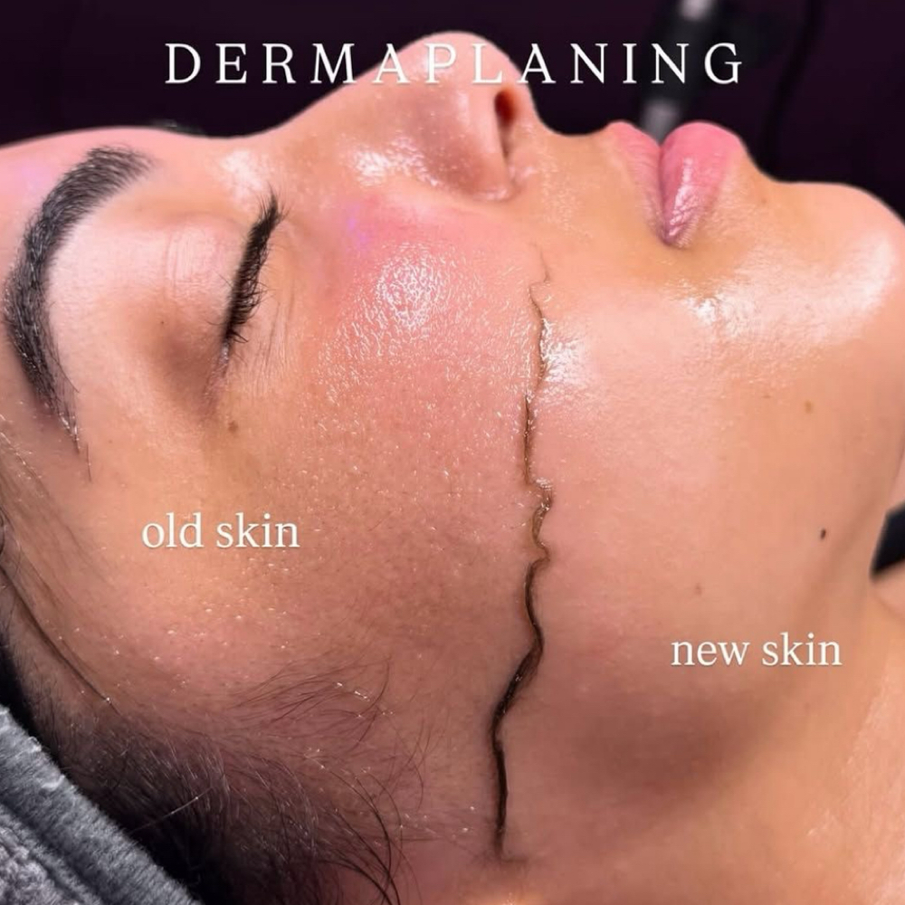 Express Dermaplane facial at ILB Esthetics in Union City, CA