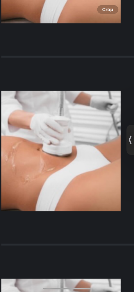 Abdomen Scultping
