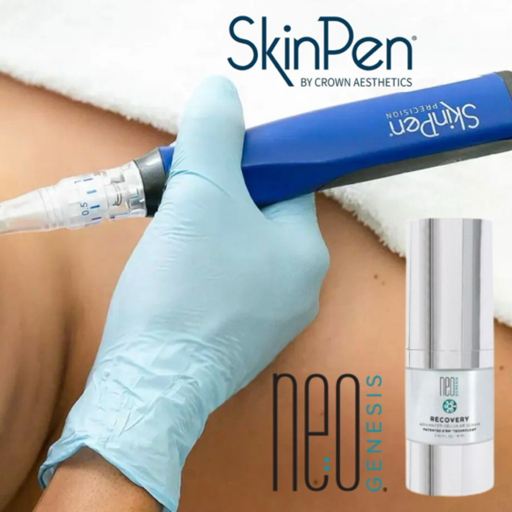 SkinPen Microneedling + Exosomes