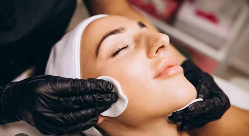 Medical Grade Chemical Peel