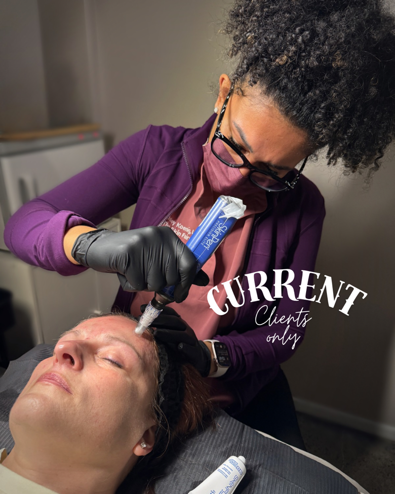 SkinPen Microneedling