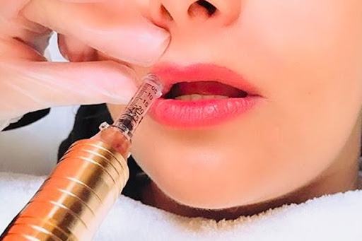Hyaluron Pen (1ml.)