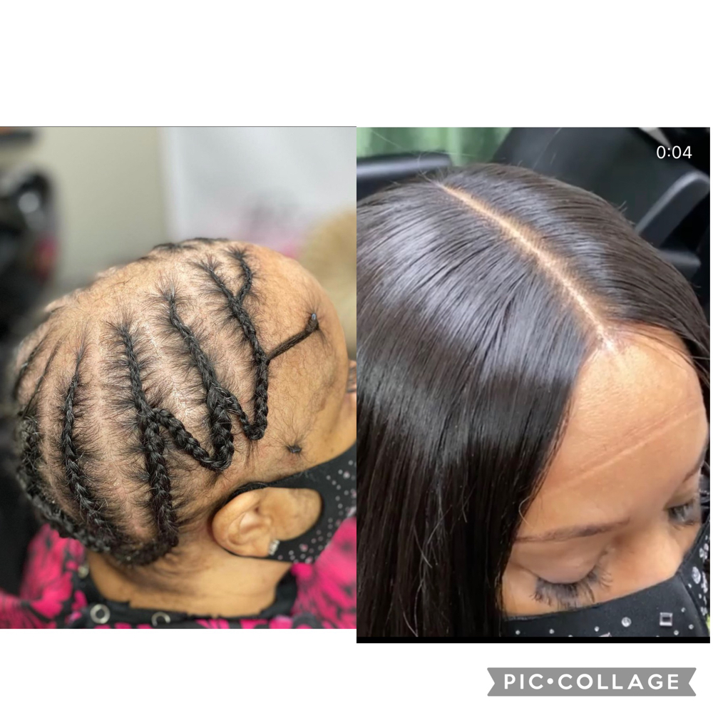 Specialty Closure Sew In-(Alopecia)