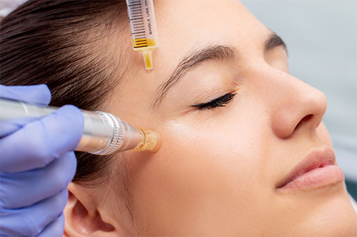 Microneedle: Under Eye
