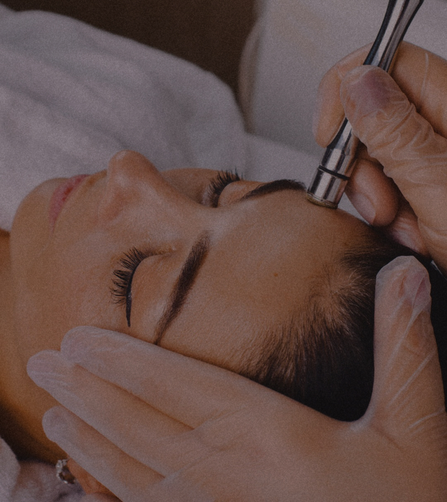 Microdermabrasion Add On