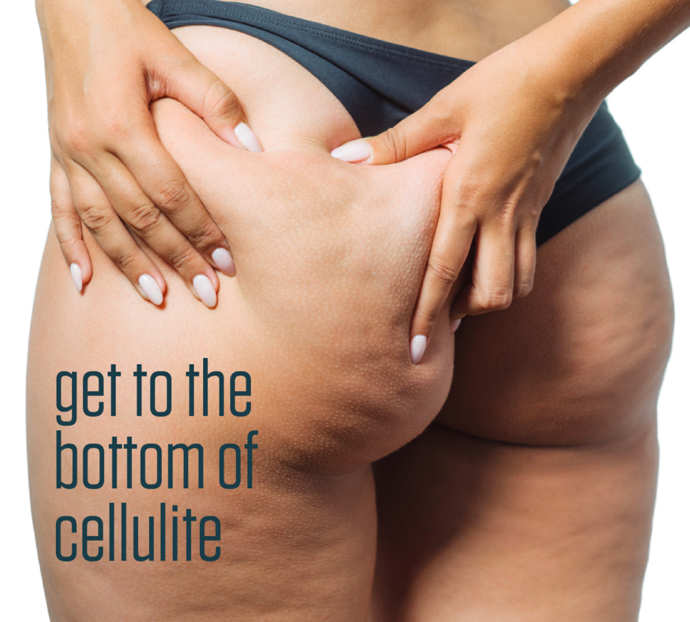 Cellulite Treatment