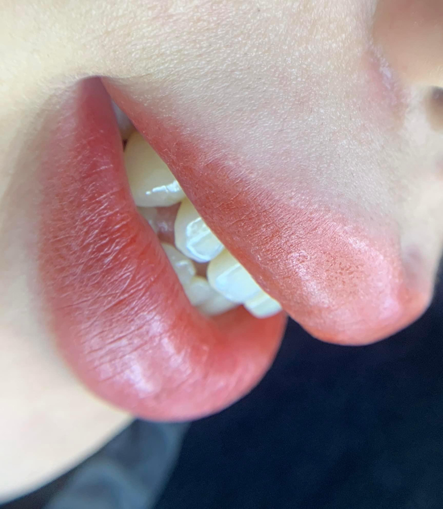 Lips Blush Touch Up( After 5 Month)