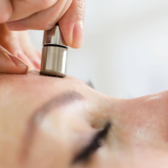 Microdermabrasion