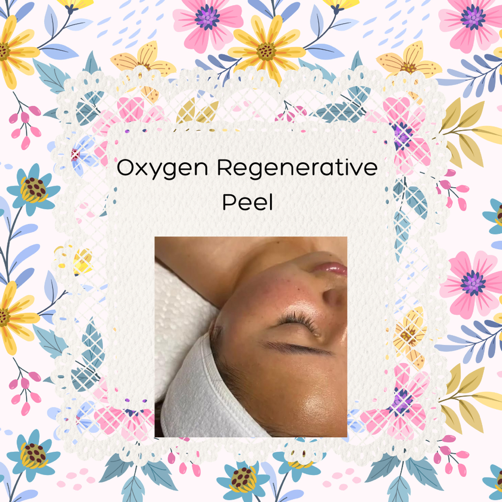 Oxygen Regenerative Peel at Skin Care By Jrobles 🤍 in Monterey, CA