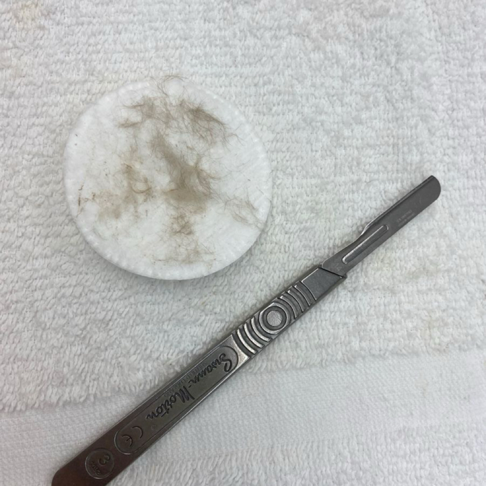 Bare & Renew Dermaplane Facial at Skin Revival Aesthetics in Ammon, ID