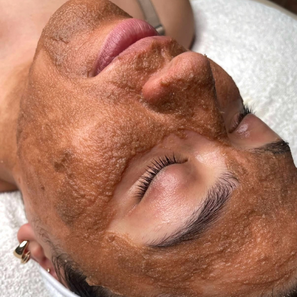 Essential Enzyme Glow at MM Esthetics in Buena Park, CA