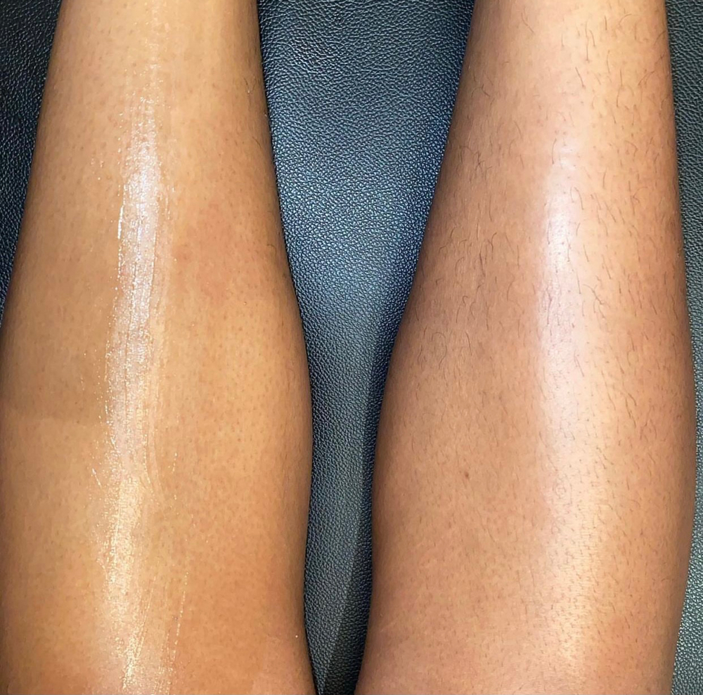 Lower Leg