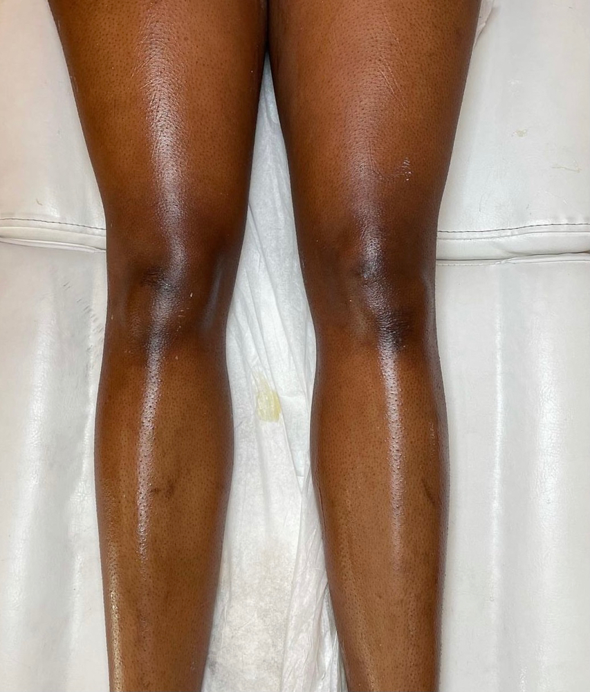 Full Leg