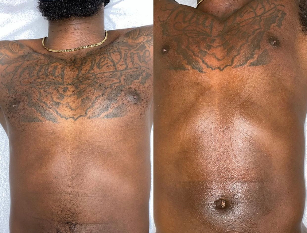 Chest (Full)