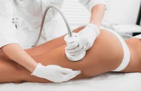 Cavitation & Skin Tightening 1Area