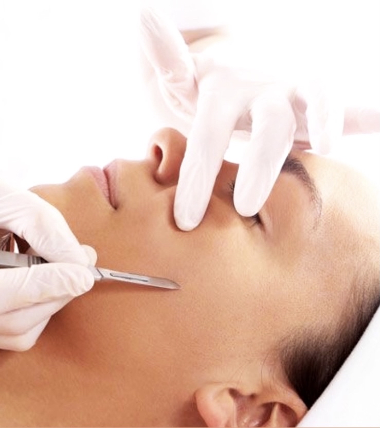 Dermaplanning + Chemical Peel