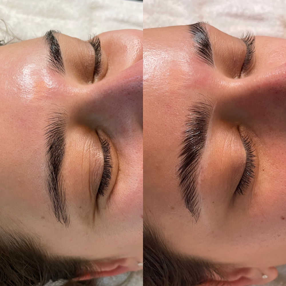 Brow Lamination