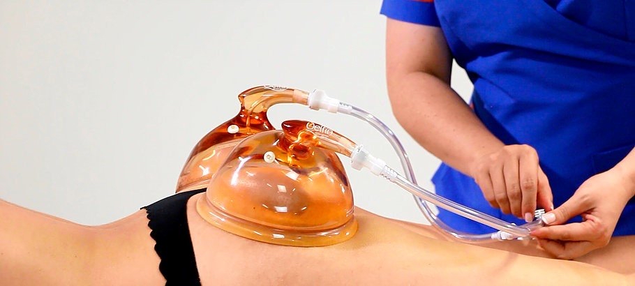 Booty vacuum therapy