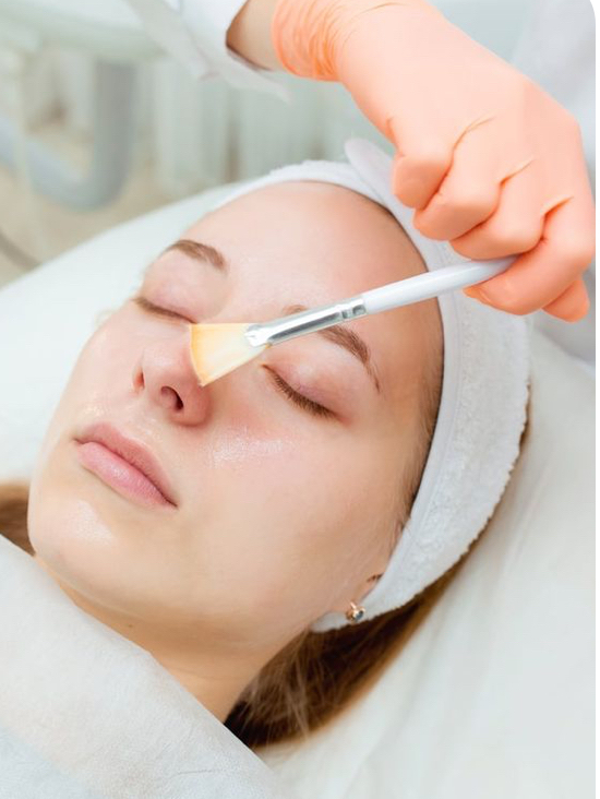 Chemical Peel