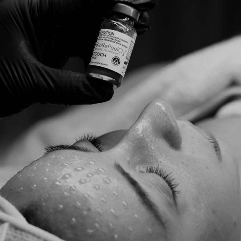 BioRePeel at Serenity Skin Studio in Asheboro, NC