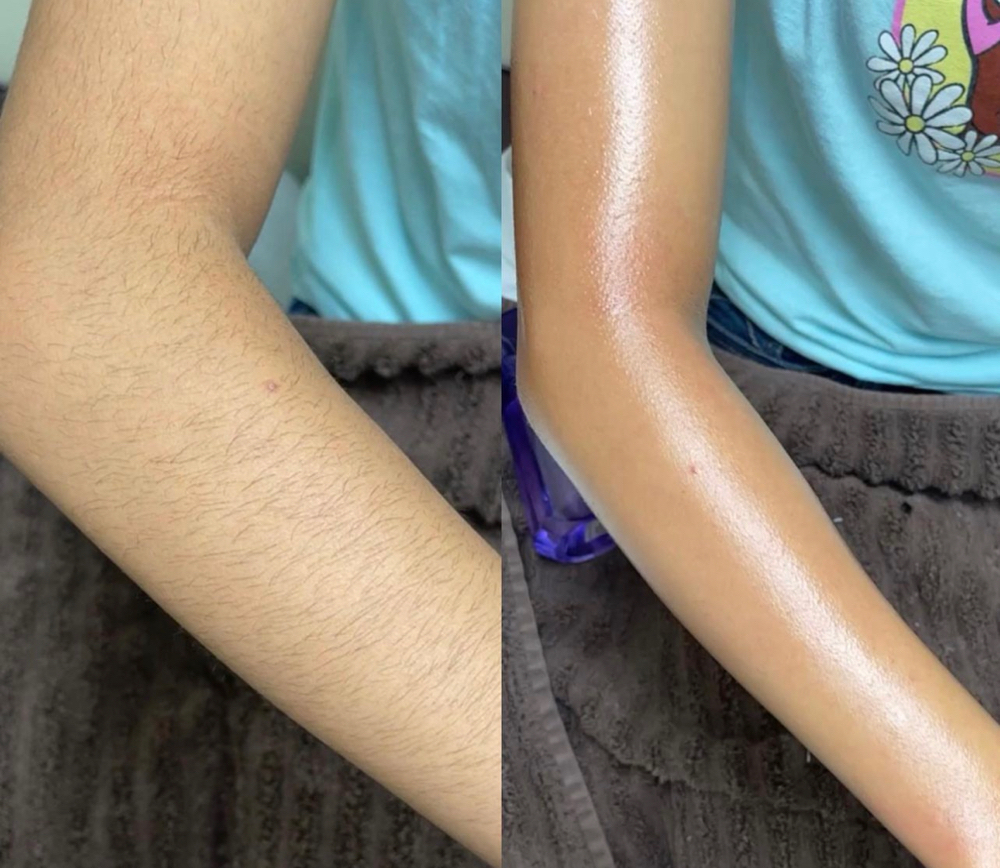 Arms