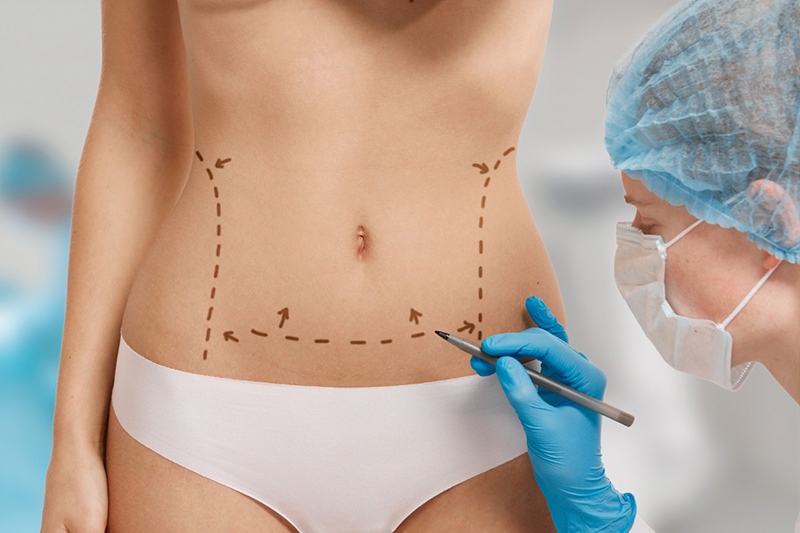 Lipo-Flack Ultra Grasa Localizada