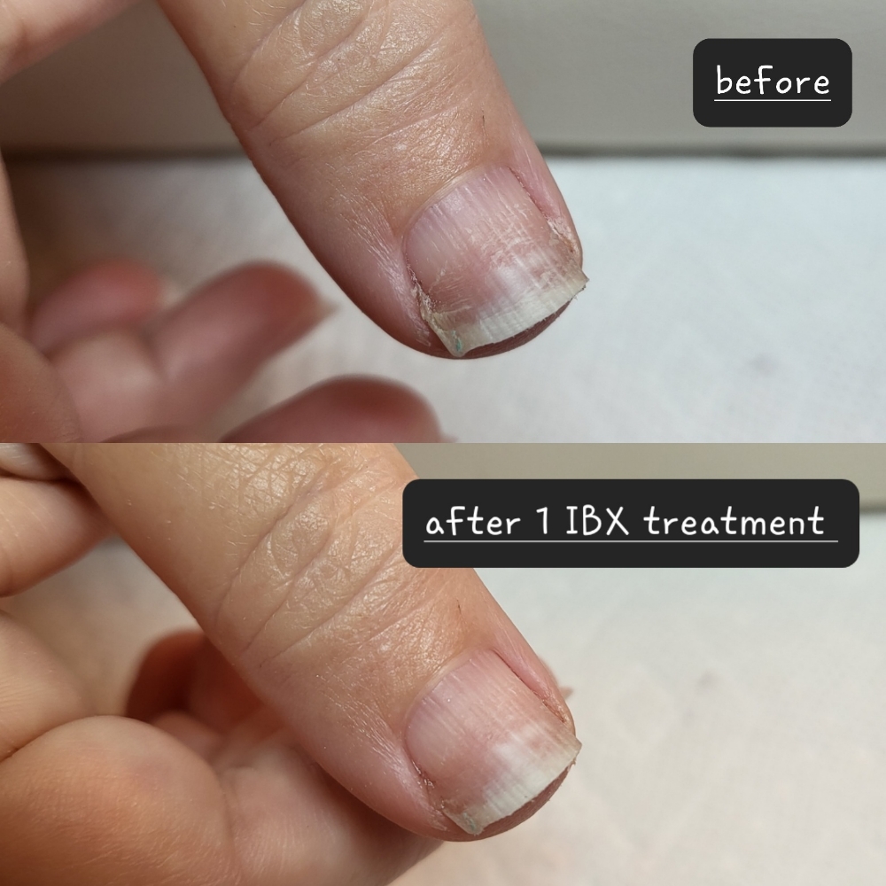 IBX Nail Strengthening Treatment