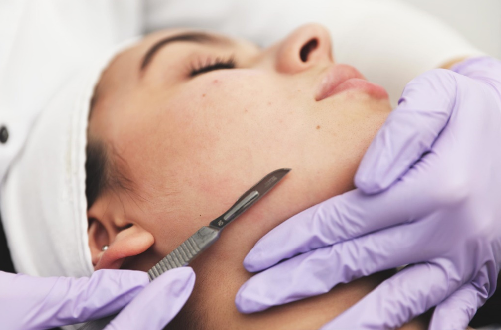 Dermaplaning