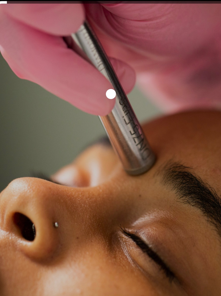 Microdermabrasion Facial