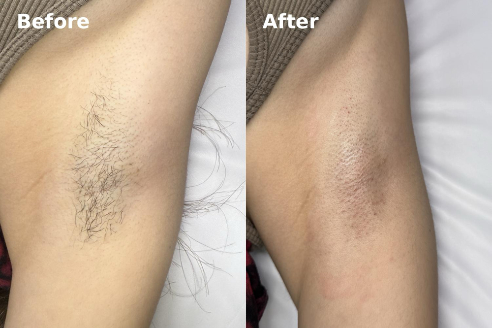 Underarm Wax at HAUSAurea in Amarillo, TX