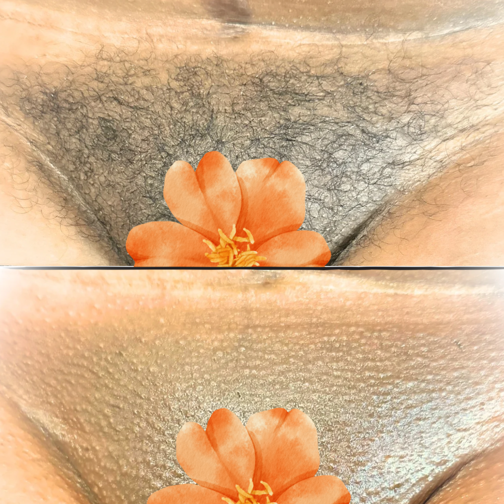 Vajacial
