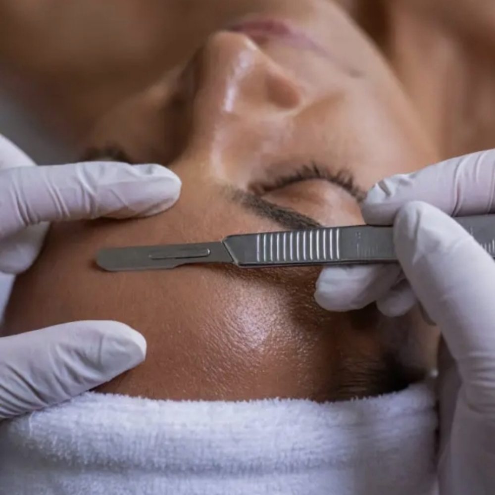 Dermaplaning