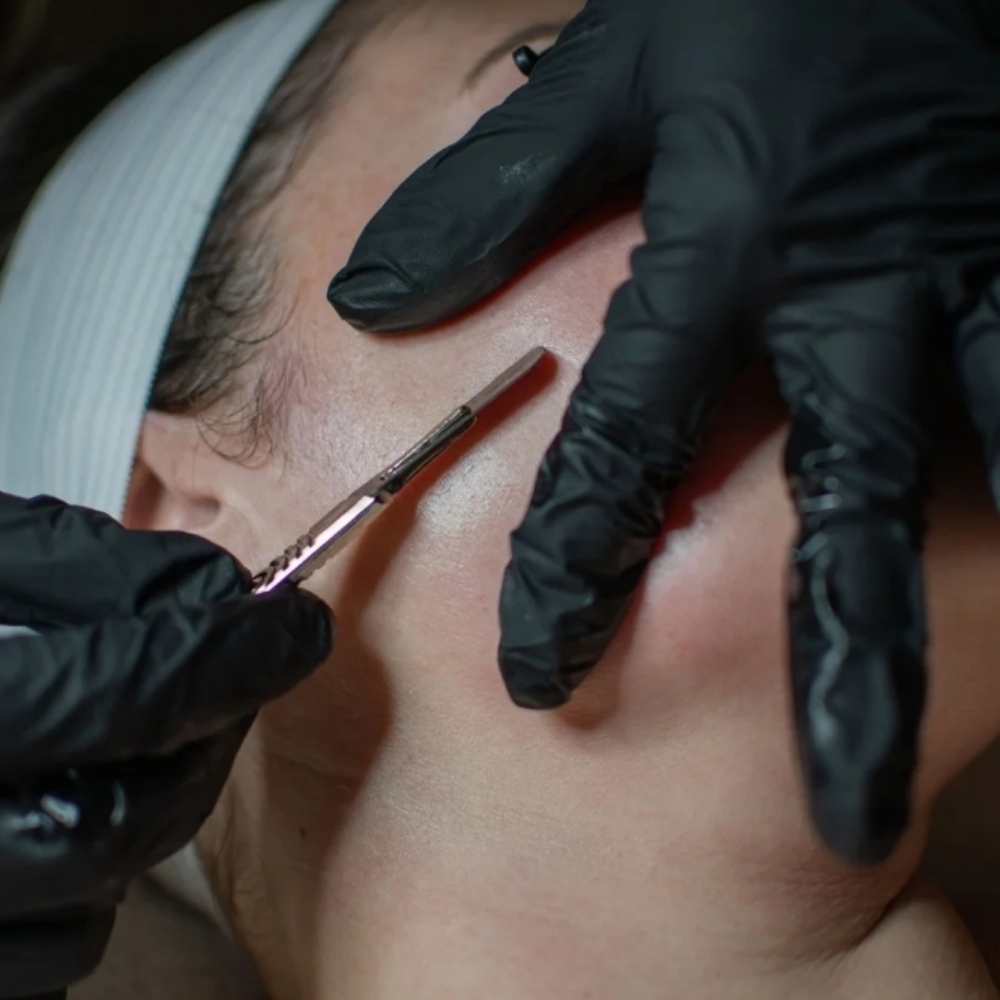 Dermaplaning at 121 Studio in Marshall, IL