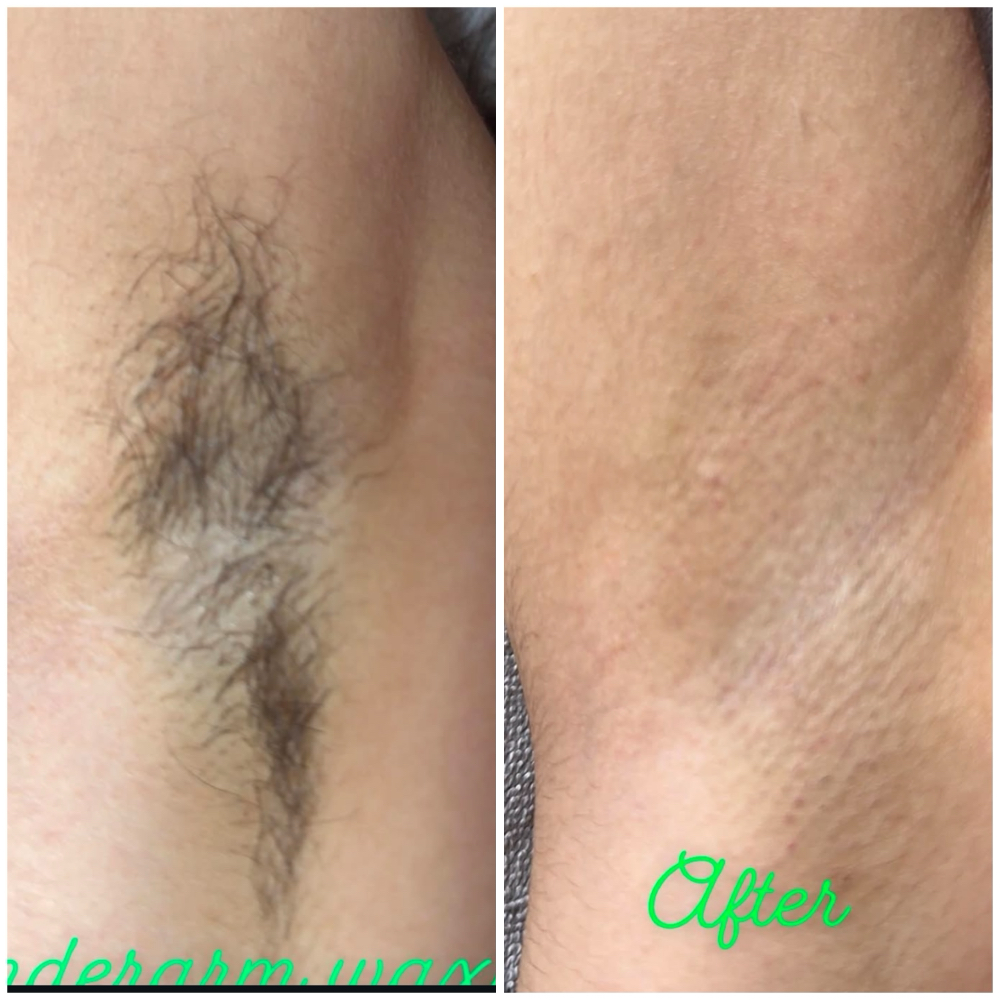 Wax Underarm