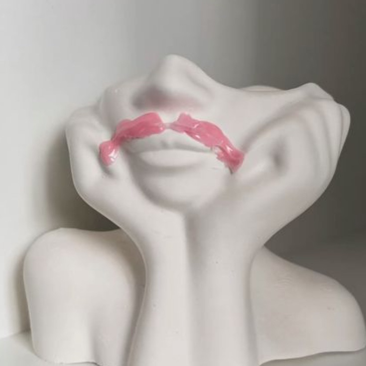Upper Lip at Touch of faith esthetics in Somerset, NJ
