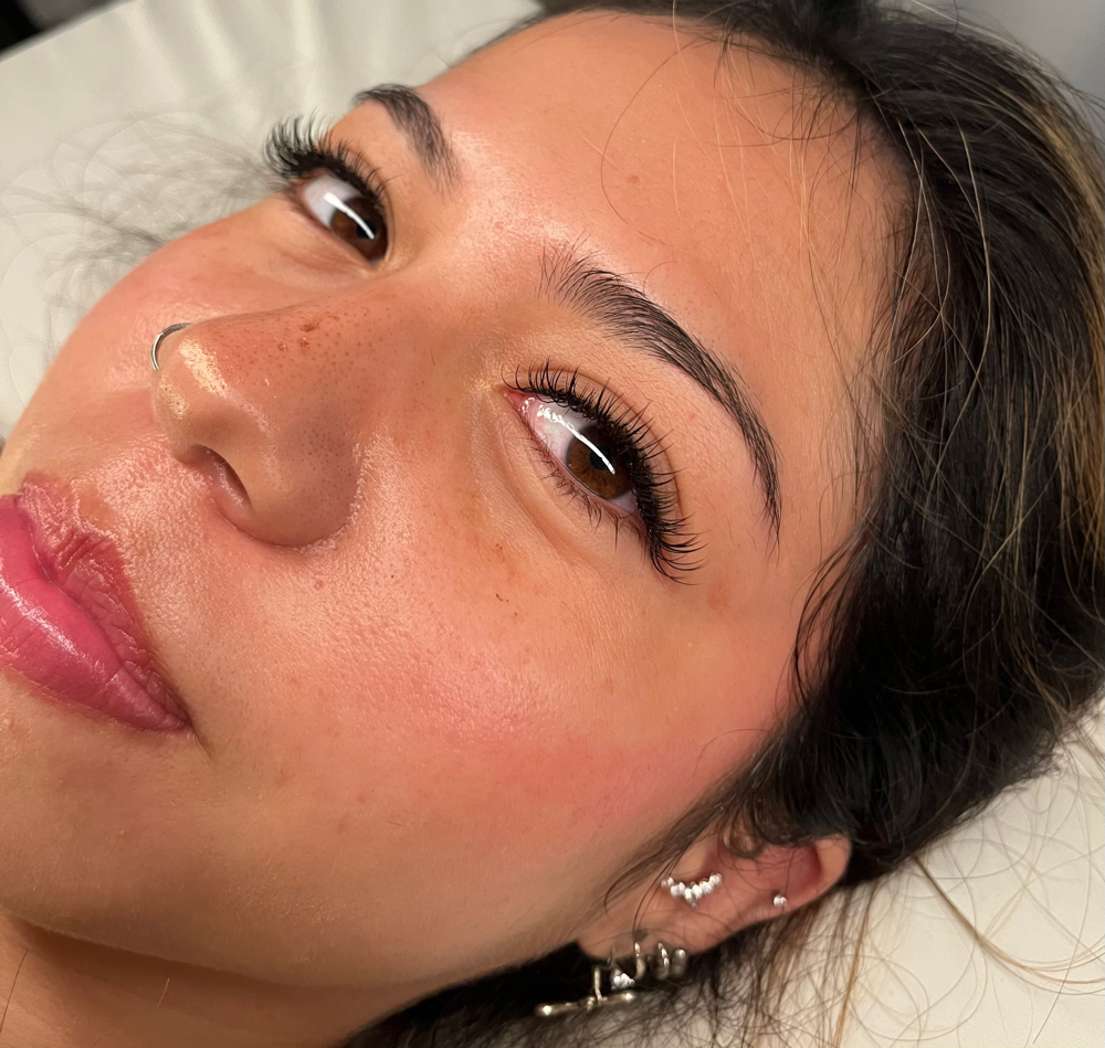 MINI FILL at BYLISETTA in Vista, CA