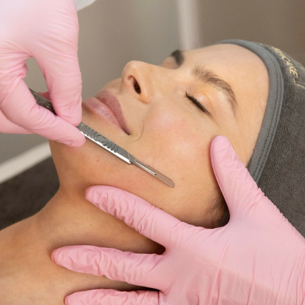 DERMAPLANE MINI FACIAL at Stephania Glow Lab in San Diego, CA