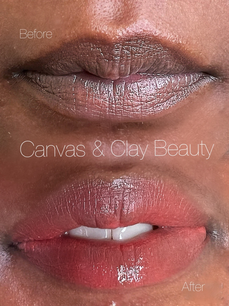 Lip Neutralization