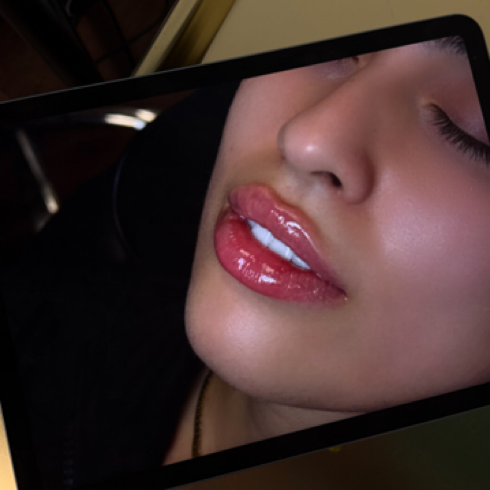 Lip Enhancement (dermal filler) at Haus of Hands Body Bar in Gahanna, OH