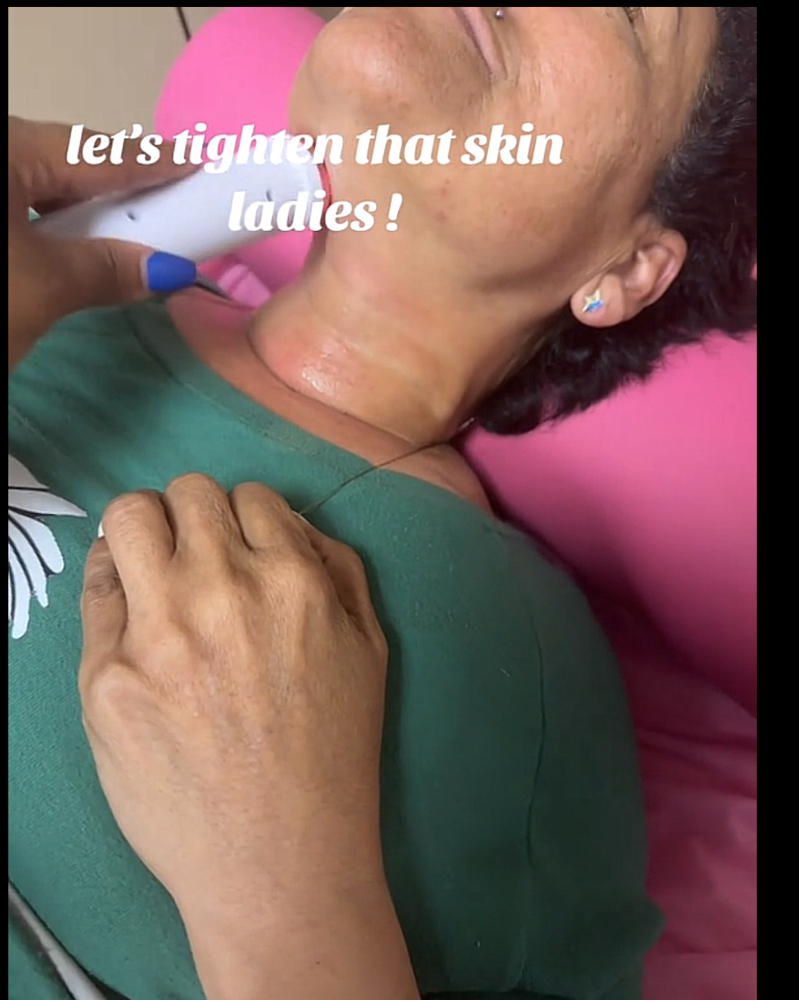 Skin Tightening