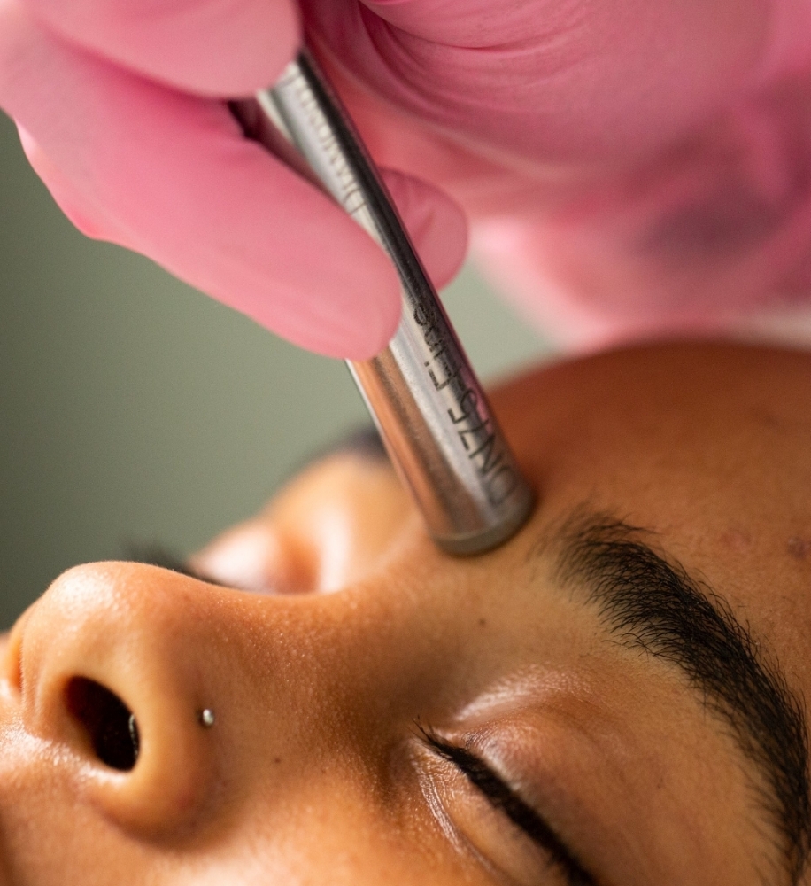 Microdermabrasion
