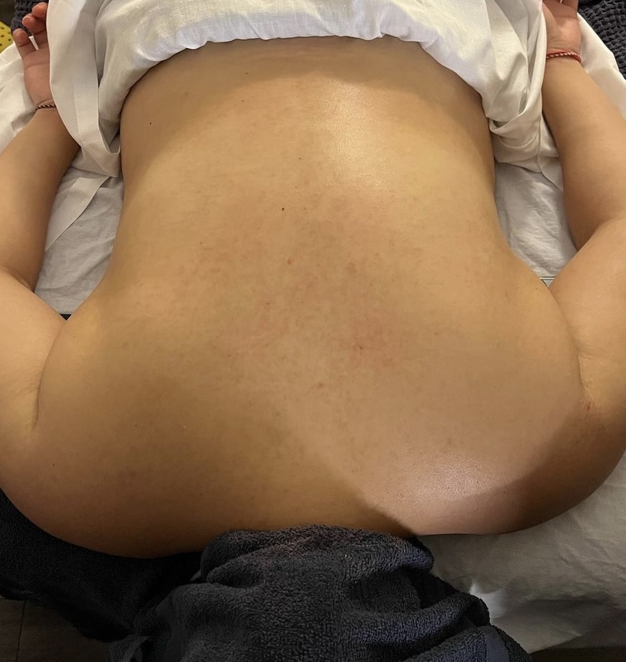 Back Facial